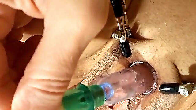 A Pump, a Vibrator, and the Clitoris Bring Her to Orgasm