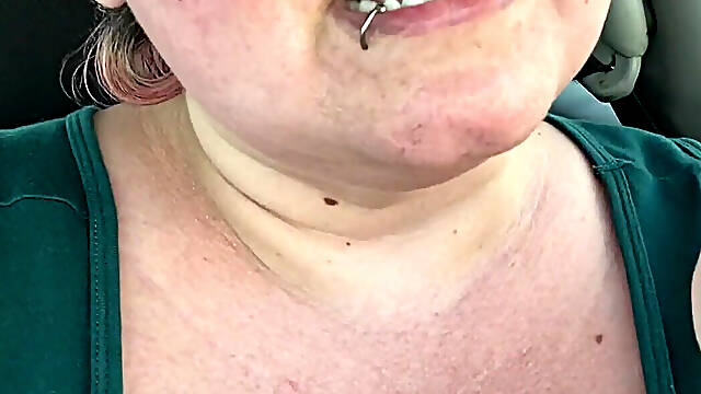 Got a Sunburn for Art Supplies!